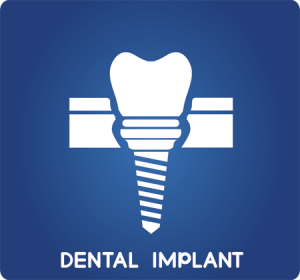 Dental-Implant-FAQ