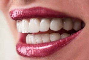 'woman smiling after receiving dental implants'