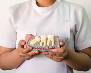 'model of wisdom tooth'