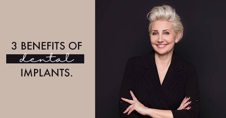 benefits on dental implants 